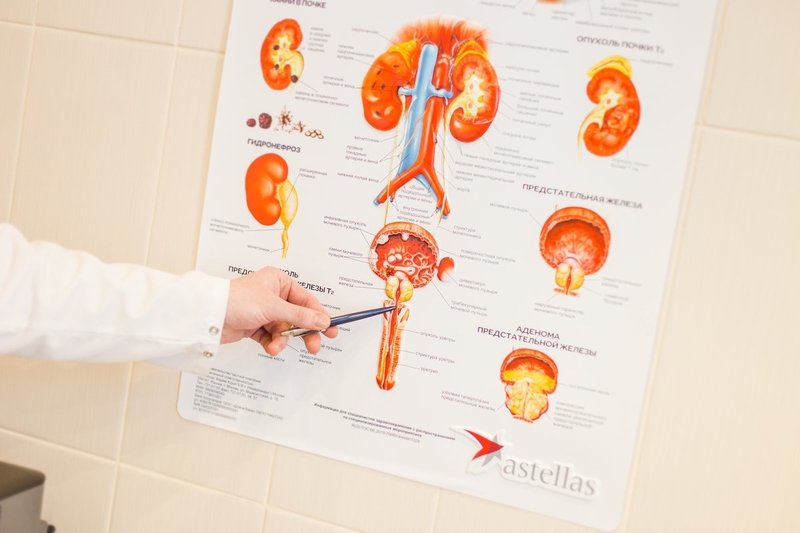 Чем опасен простатит и как с ним бороться