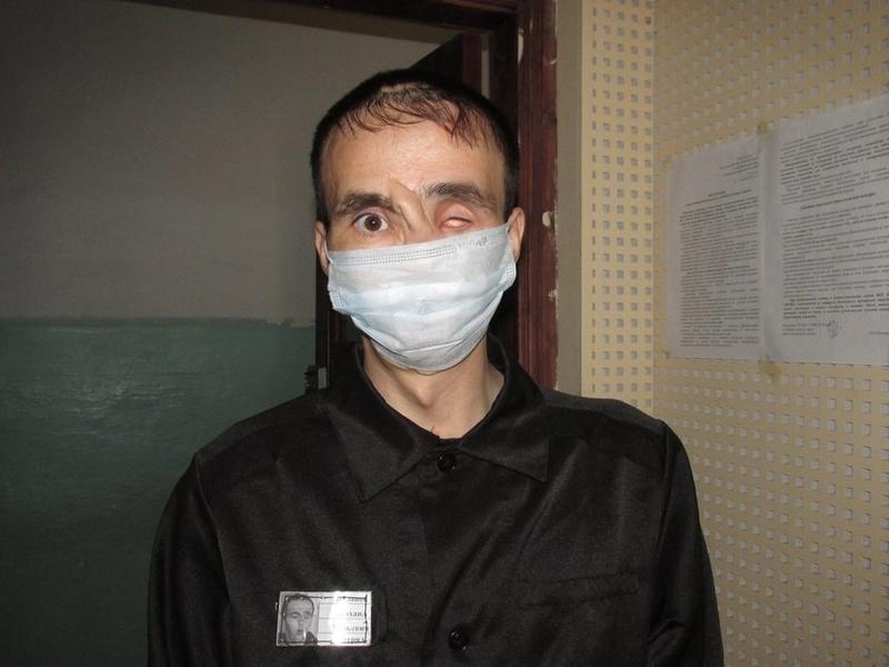 Осужденному забайкальцу, который выстрелил себе в лицо, перенесли операцию из-за коронавируса (18+)