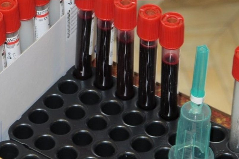 Более 80-ти женщин, больных СПИДом, родили здоровых детей в прошлом году