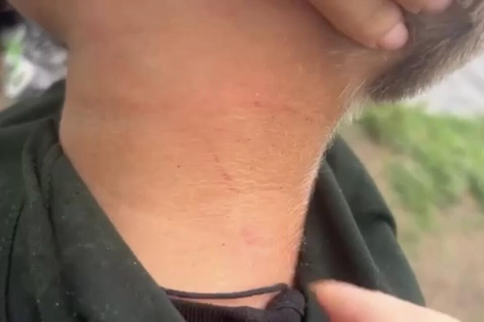 В Чите мужчина избил подростка