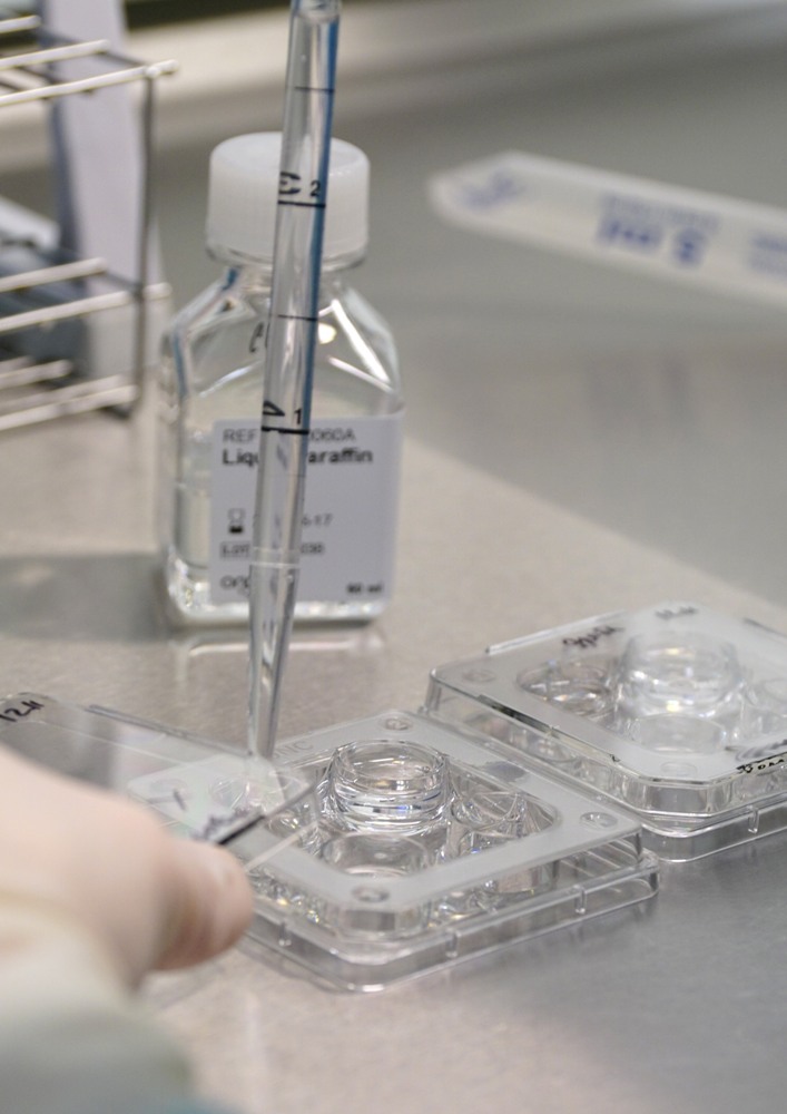 Оборудование для искусственного оплодотворения за 1,8 млн р закупили в Забайкалье