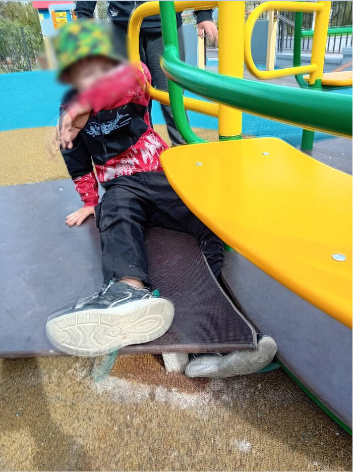 Ещё одному ребёнку зажало ногу на карусели в парке «Коллективный труд»