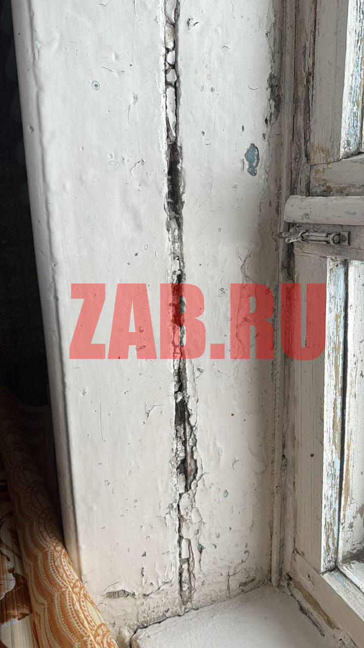 Борзинцы ужаснулись состоянием отделения гинекологии в местной ЦРБ